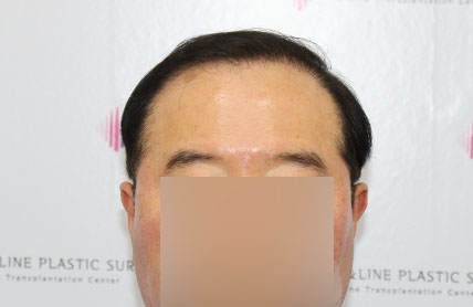 치료후기 이미지