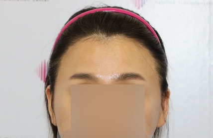 치료후기 이미지