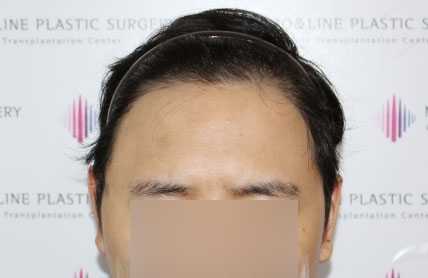 치료후기 이미지