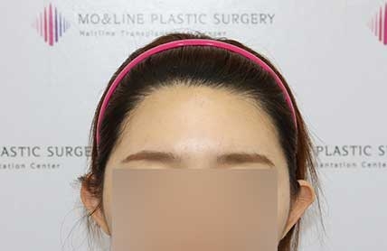 치료후기 이미지