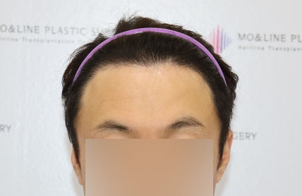 치료후기 이미지