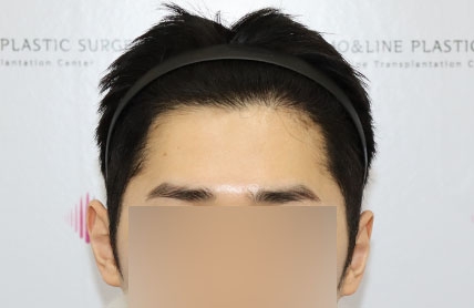 치료후기 이미지