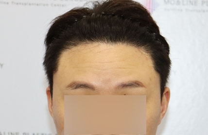 치료후기 이미지