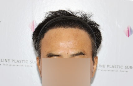 치료후기 이미지