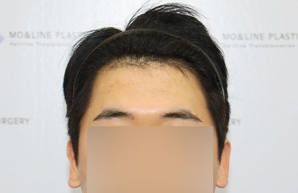 치료후기 이미지