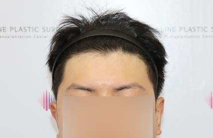 치료후기 이미지