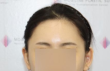 치료후기 이미지