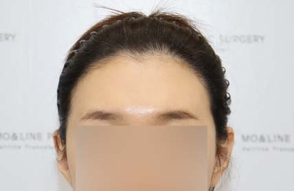 치료후기 이미지