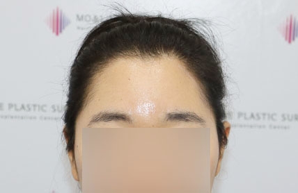 치료후기 이미지