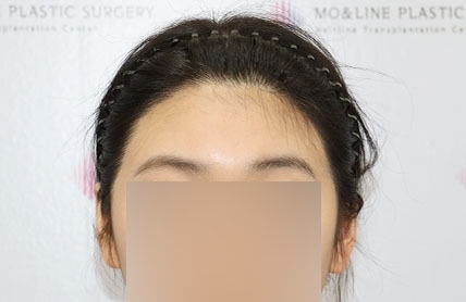 치료후기 이미지