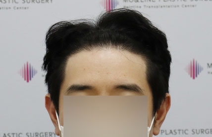 치료후기 이미지