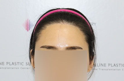 치료후기 이미지
