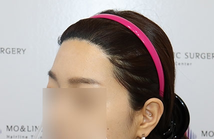 치료후기 이미지