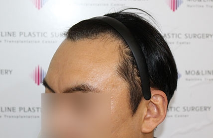 치료후기 이미지