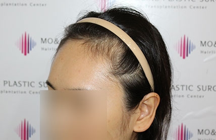 치료후기 이미지