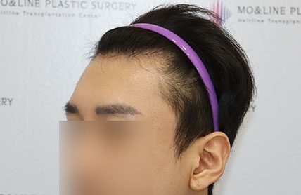 치료후기 이미지