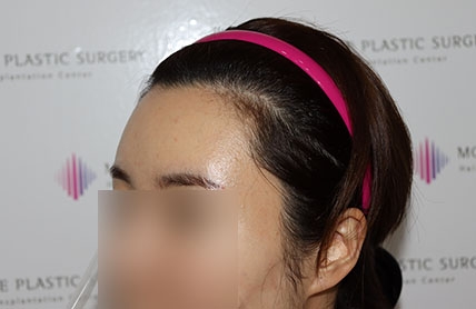 치료후기 이미지