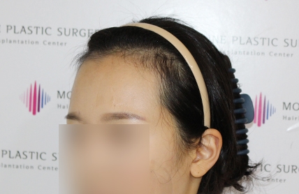 치료후기 이미지