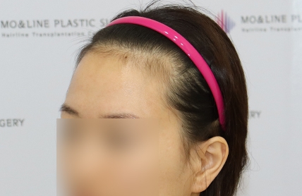 치료후기 이미지