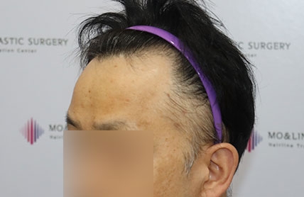 치료후기 이미지