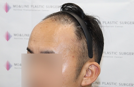 치료후기 이미지