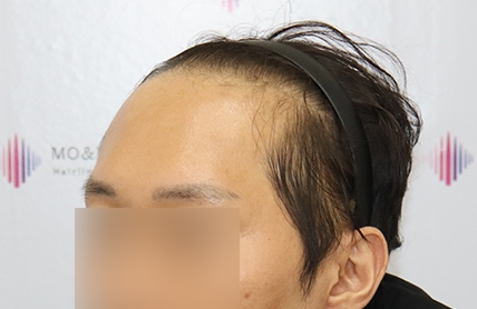 치료후기 이미지