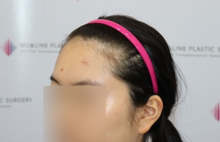치료후기 이미지