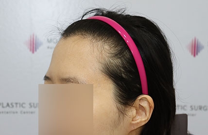 치료후기 이미지