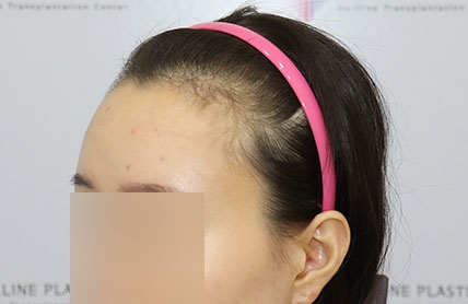 치료후기 이미지