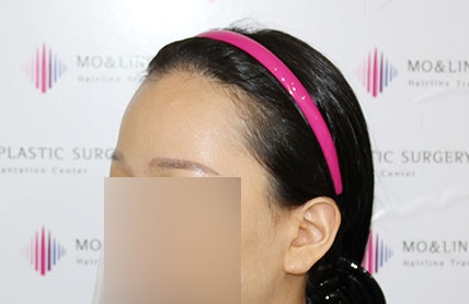 치료후기 이미지