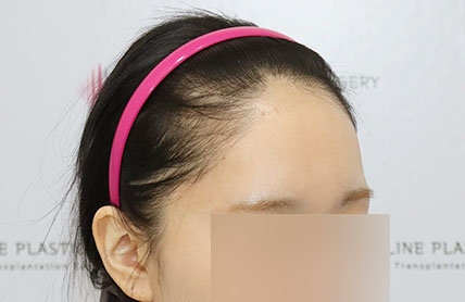 치료후기 이미지