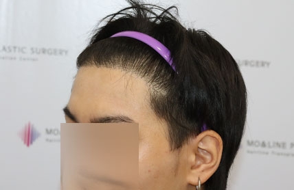 치료후기 이미지