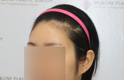 치료후기 이미지