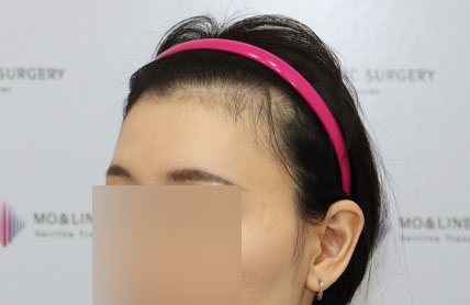 치료후기 이미지