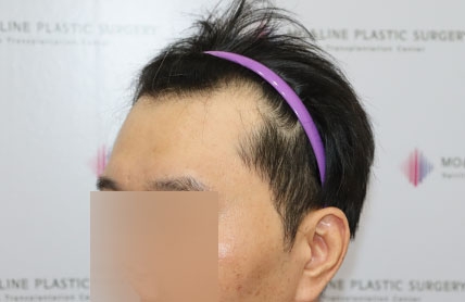 치료후기 이미지