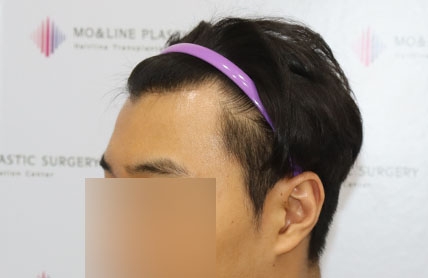 치료후기 이미지