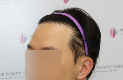 치료후기 이미지
