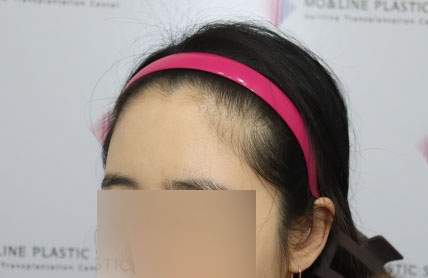 치료후기 이미지