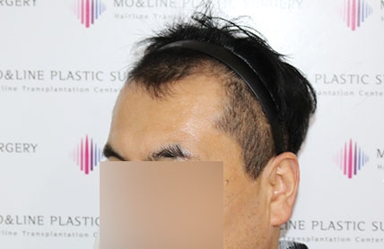 치료후기 이미지