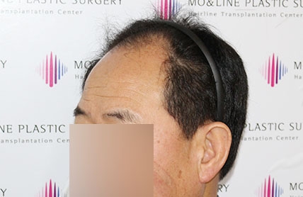 치료후기 이미지