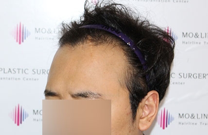 치료후기 이미지