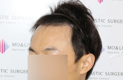 치료후기 이미지