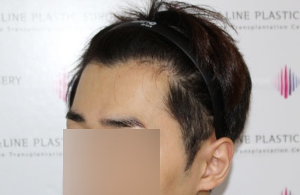 치료후기 이미지