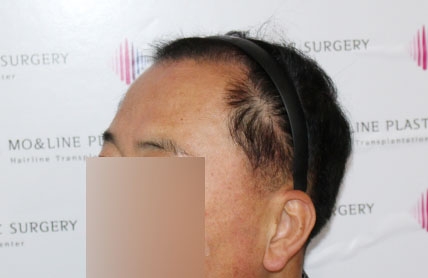 치료후기 이미지