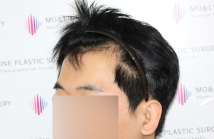 치료후기 이미지