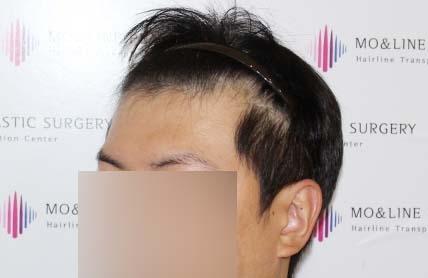 치료후기 이미지