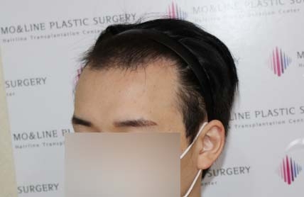 치료후기 이미지