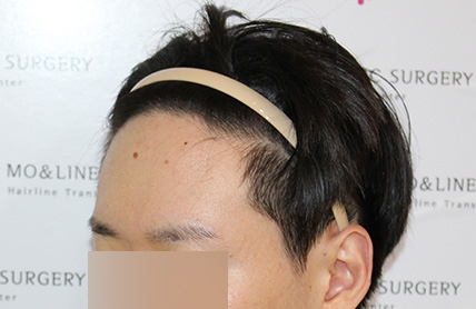 치료후기 이미지