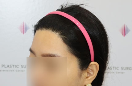치료후기 이미지