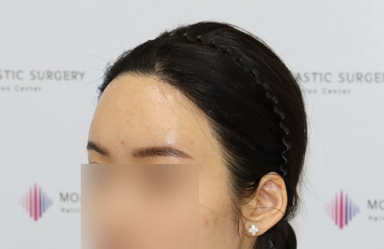 치료후기 이미지